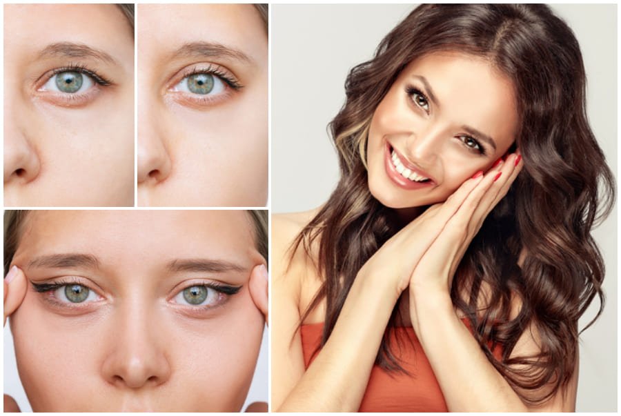 Обвисшие веки — как от них избавиться?